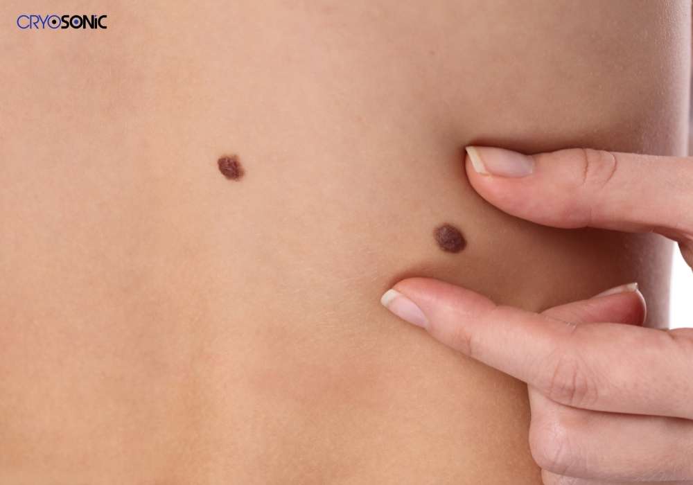 Infection Risk and Poor Aftercare Swansea